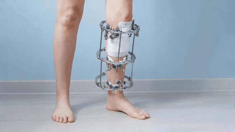 تأمین سرمایه در گردش برای تولید محصولات ارتوپدی